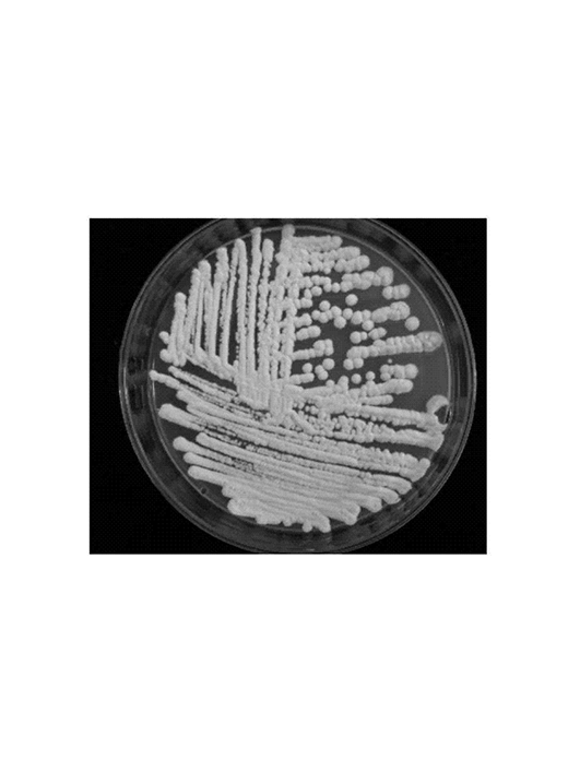 扣囊復膜孢酵母